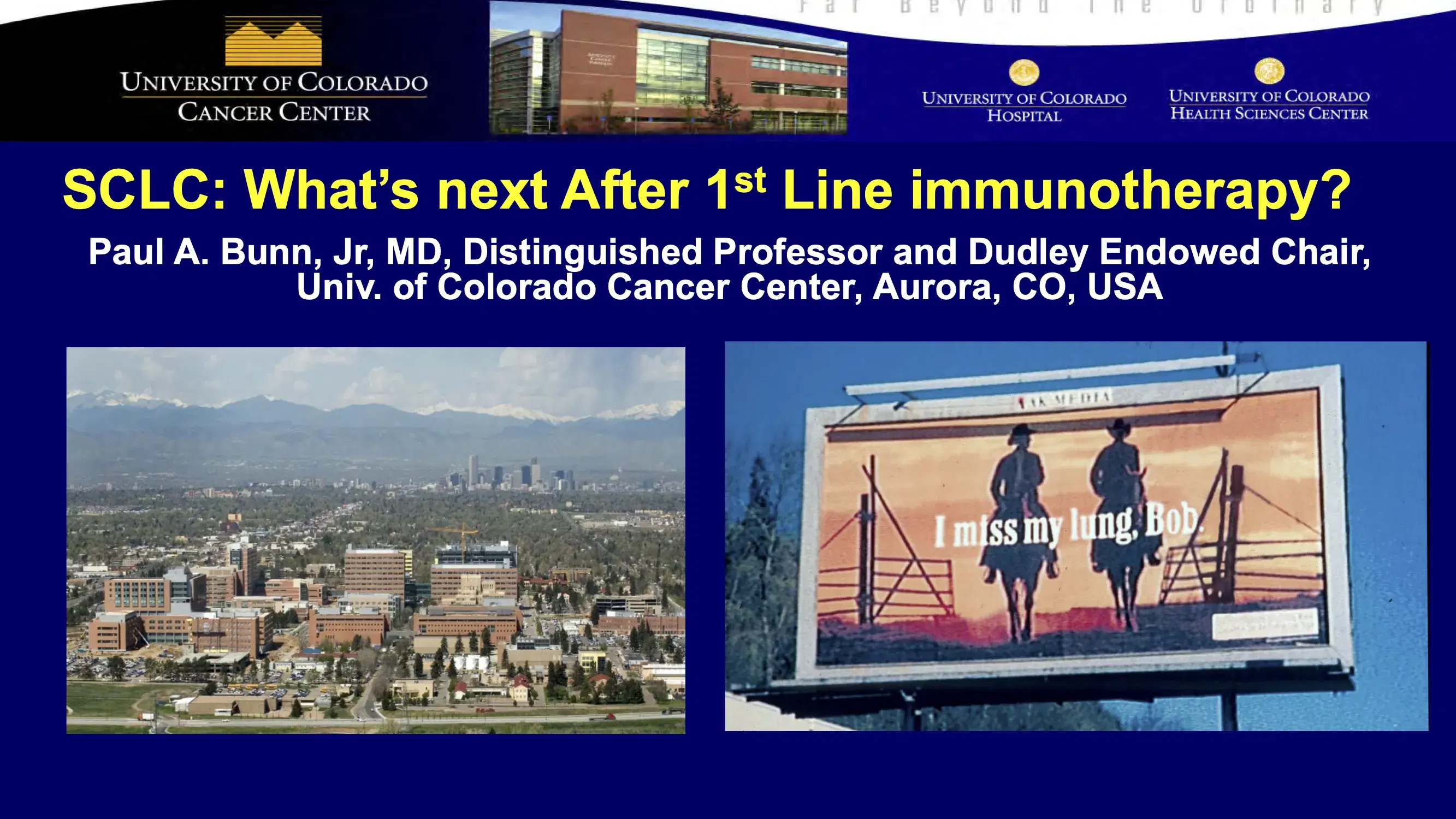2021 NOSCM | Small Cell Lung Cancer: After Immunochemotherapy, What’s Next?