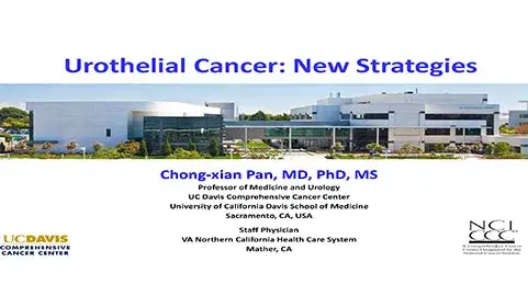 Urothelial Cancer New Strategies