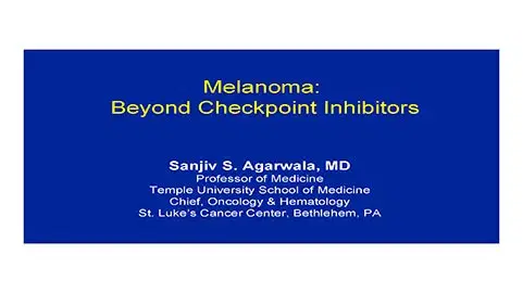 Melanoma: Beyond Checkpoint Inhibitors