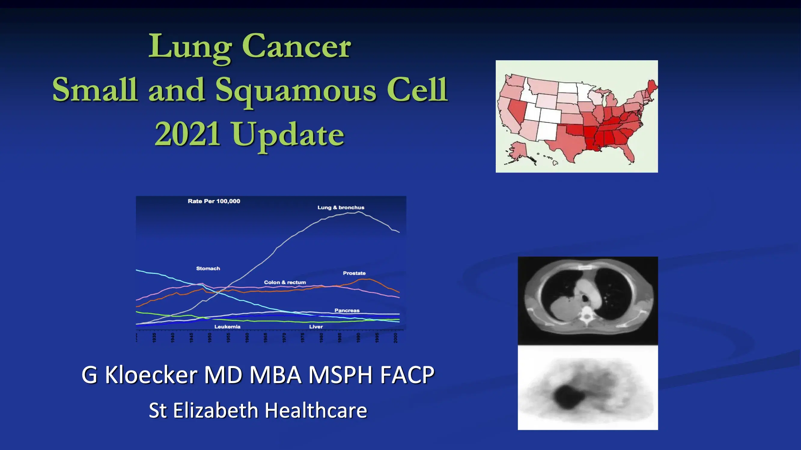 Small cell and Squamous Cell Lung Cancer Update
