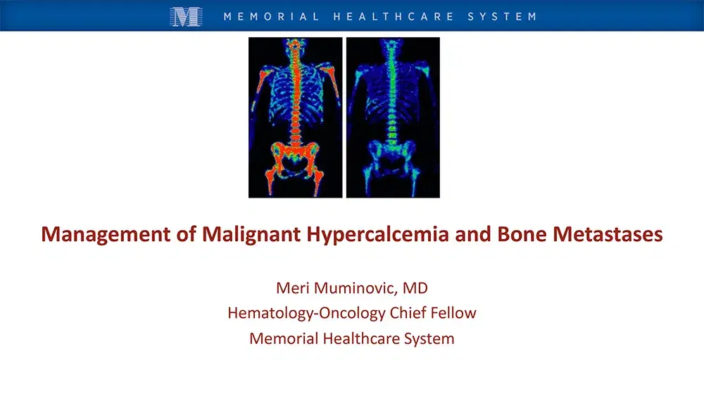 2024 MCM | Management of Malignant Hypercalcemia, Bone Metastases & Standard Precautions to Decrease Adverse Events