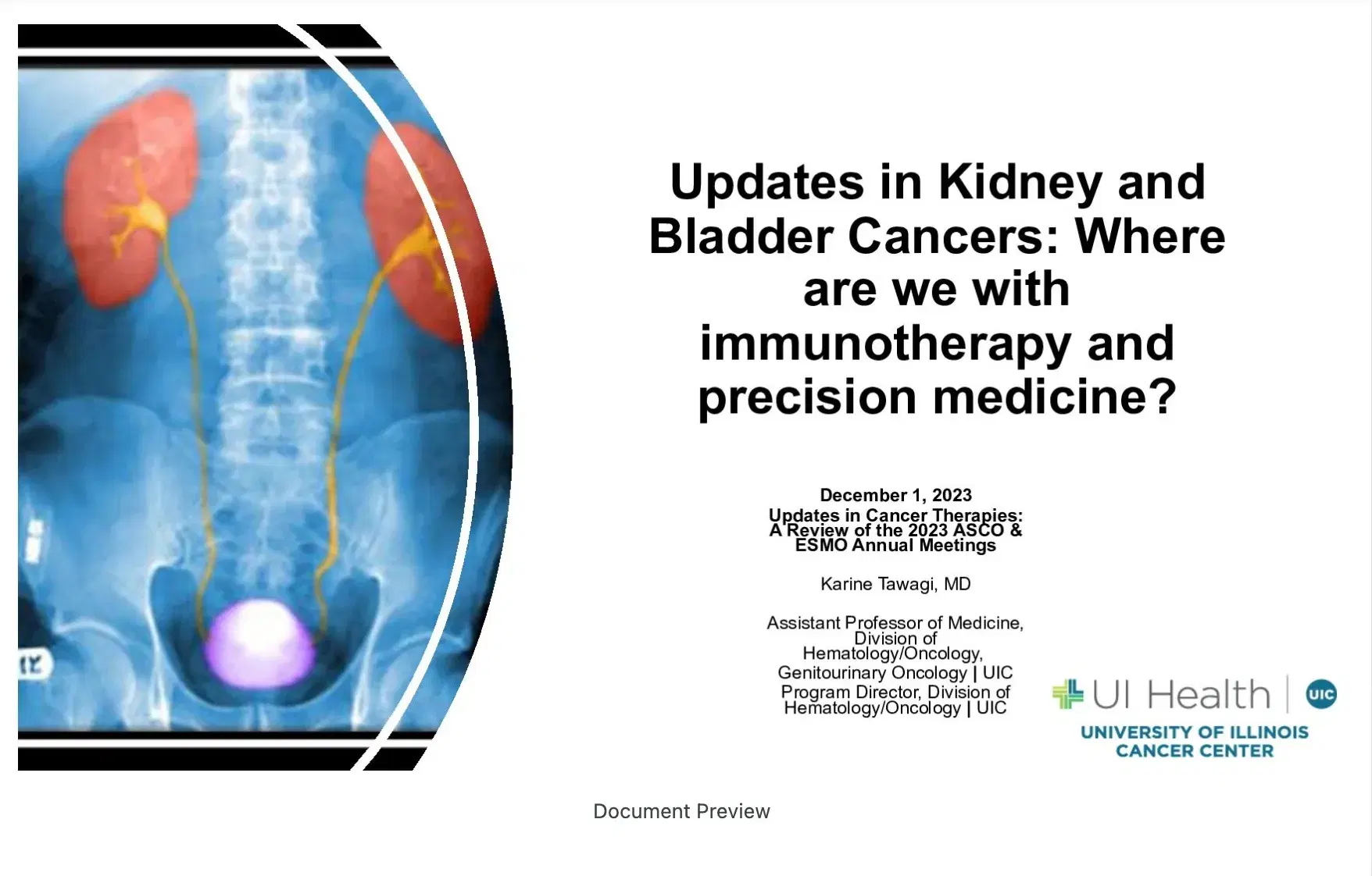 2023 UCT | Updates in Kidney and Bladder Cancers: Where we are with Immunotherapy and Precision Medicine?