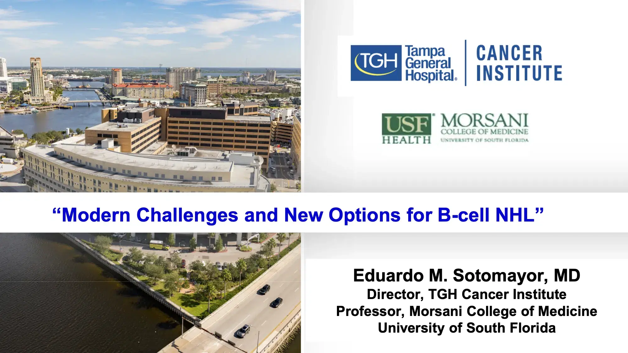 2022 UCT | Modern Challenges and new options for B-cell NHL