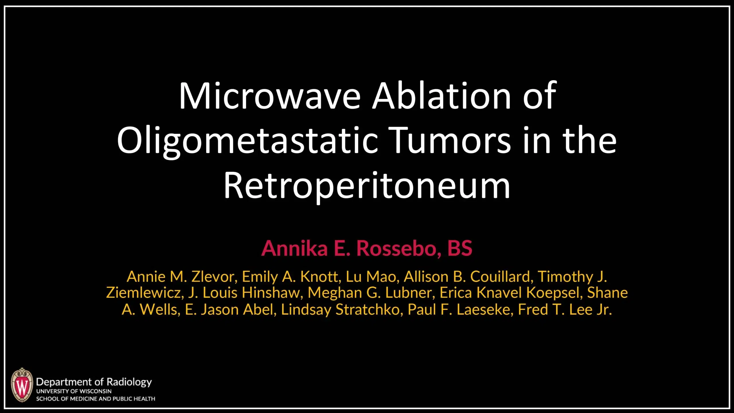 2024 SPECTRUM | Microwave Ablation of Oligometastatic Tumors in the Retroperitoneum