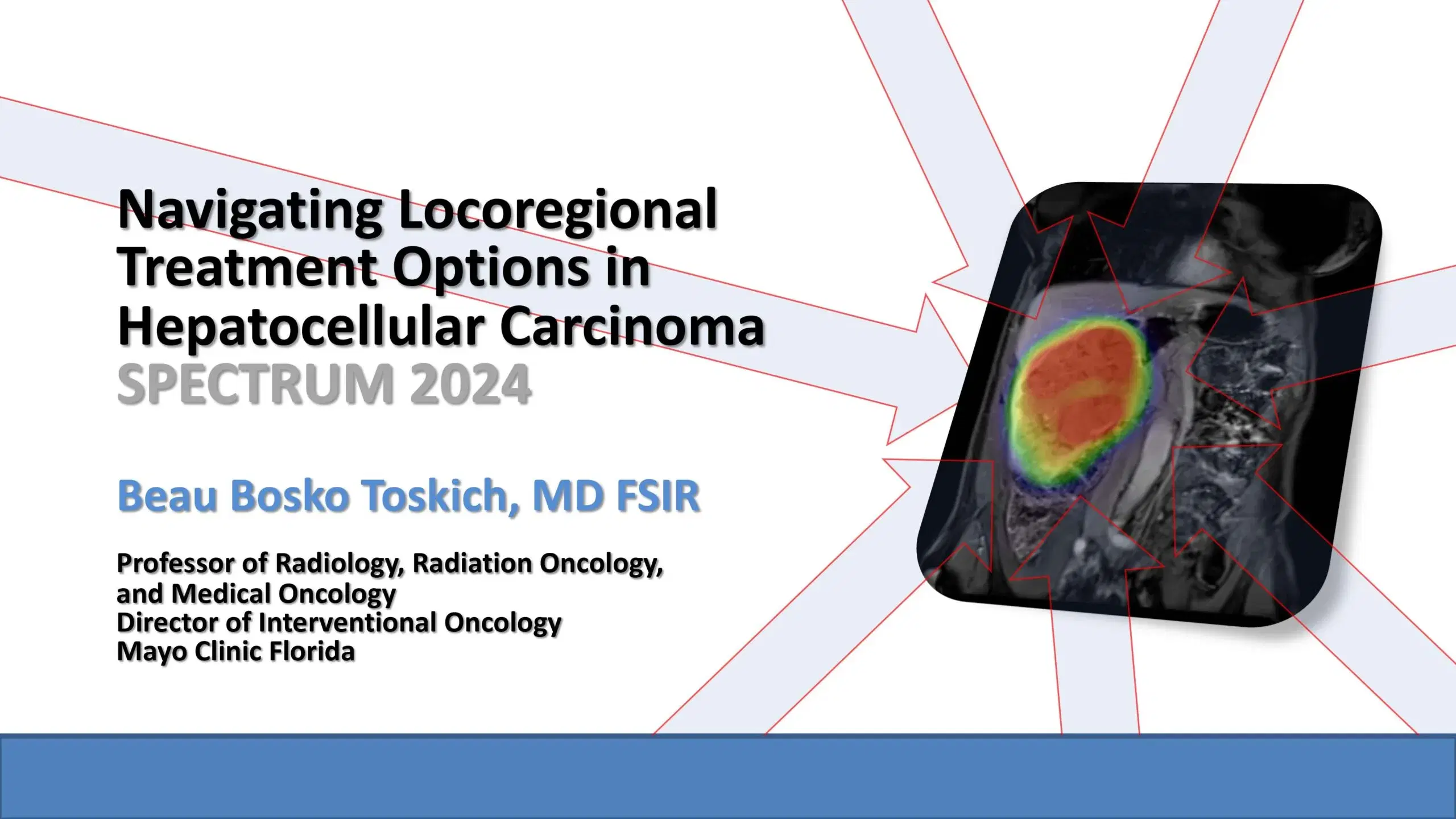 2024 SPECTRUM | Navigating locoregional treatment options in HCC