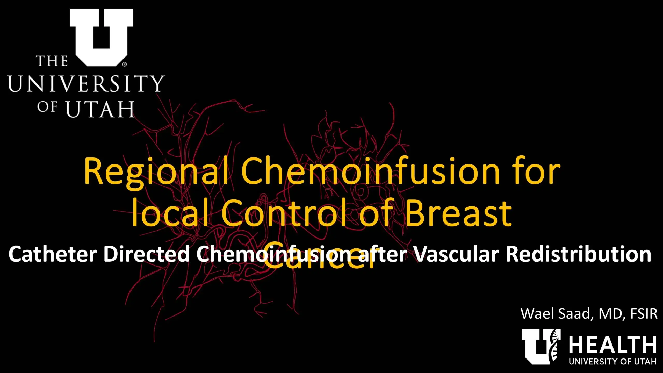 2024 SPECTRUM | Transcatheter treatment in breast cancer