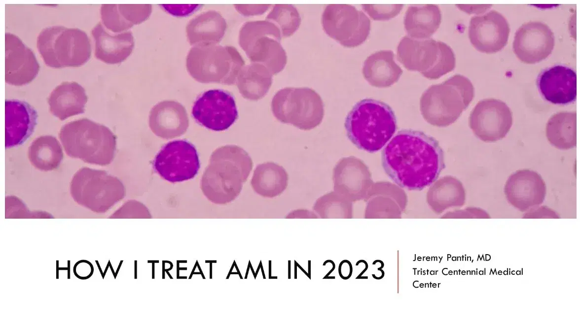 How I Treat AML in 2023